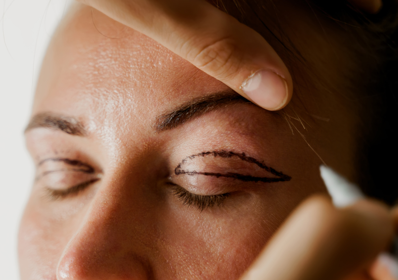 Blefaroplastia: como funciona a cirurgia de pálpebras?