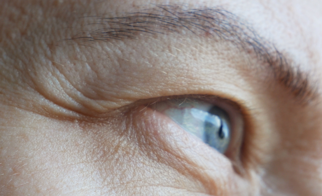 Ptose palpebral: causas, sintomas e tratamento