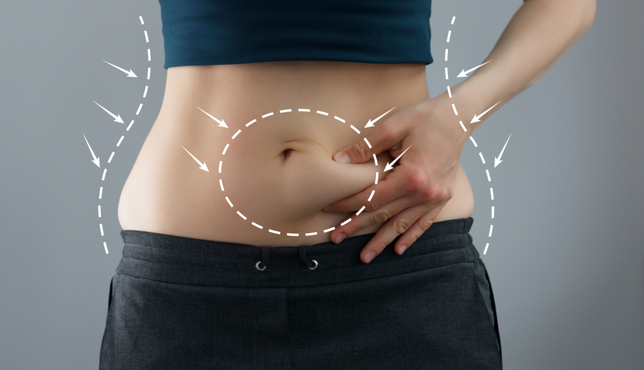 Abdominoplastia: indicação e como é feita