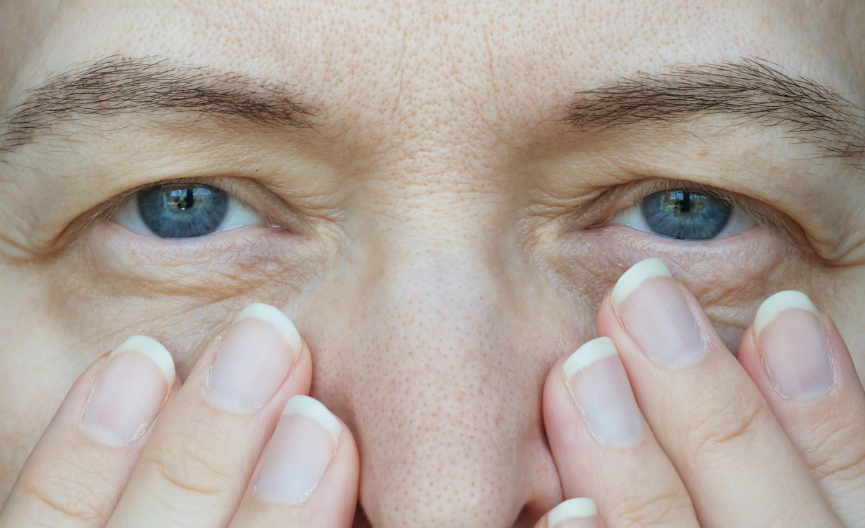 Ptose palpebral: causas, sintomas e tratamento