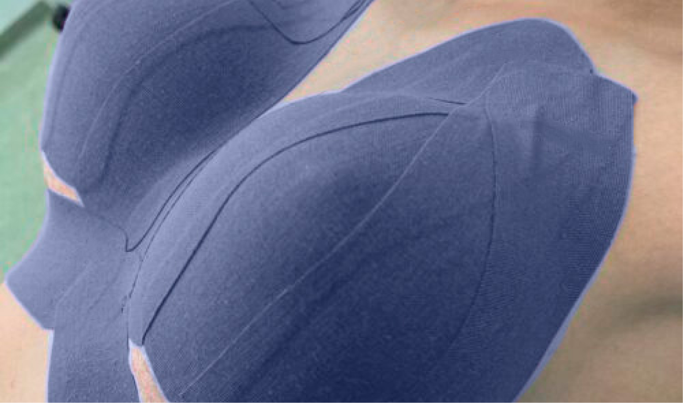 Mamoplastia: definição, tipos e cuidados